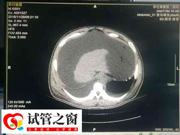 試管嬰兒是一種體外受精技術(shù)