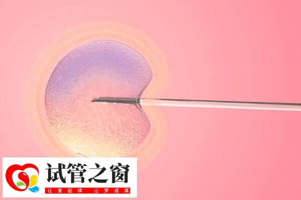 柬埔寨試管成功率很高